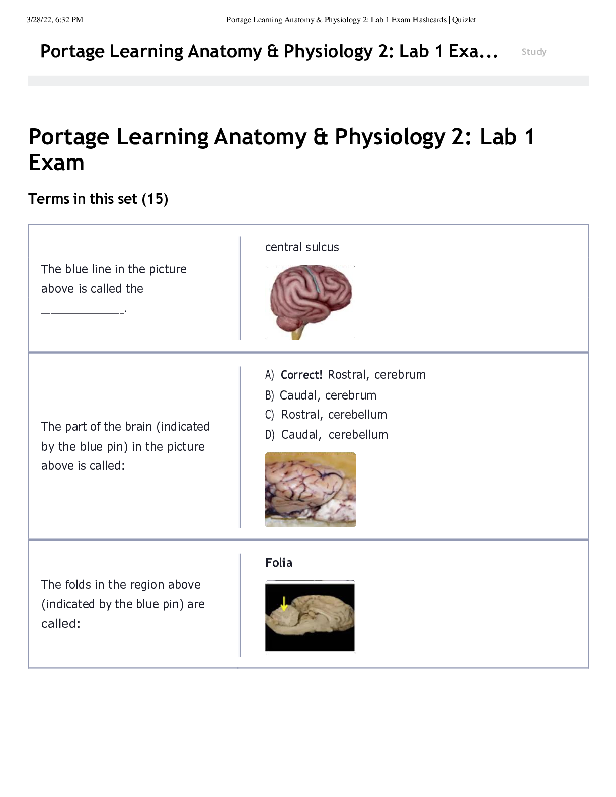 Preview of Nursing BS 231 Portage Learning Anatomy & Physiology 2_ Lab 1 Exam Flashcard